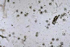 Coccidia